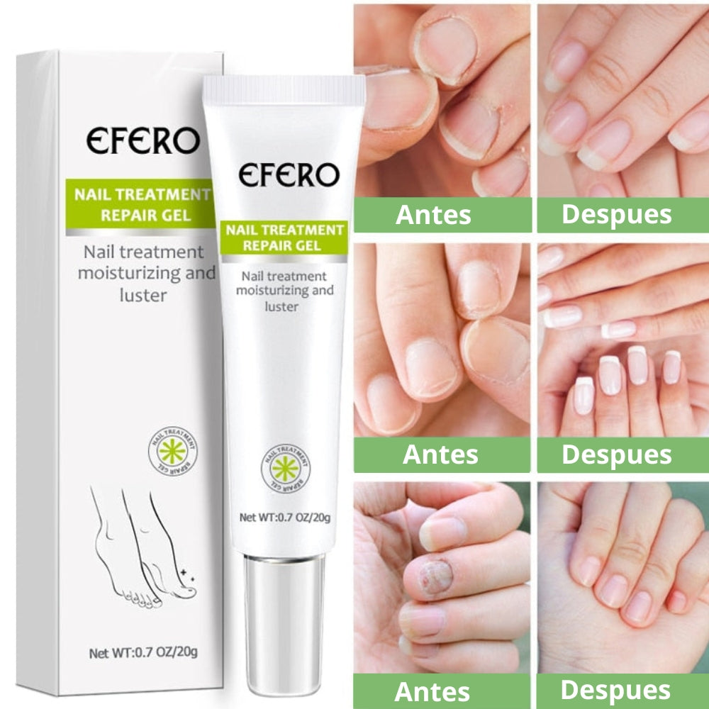 Crema de eliminación de hongos + regalos [RESULTADO COMPROBADO].