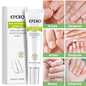 Crema de eliminación de hongos + regalos [RESULTADO COMPROBADO].