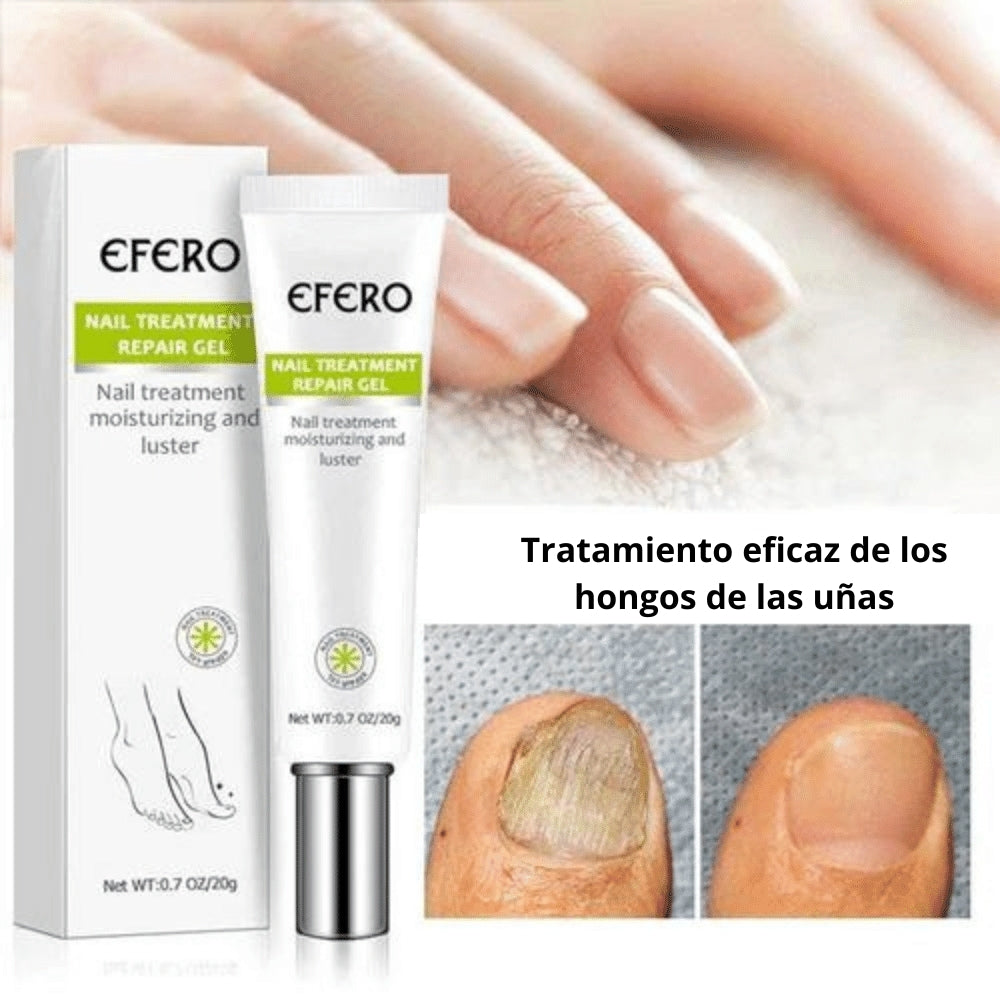 Crema de eliminación de hongos + regalos [RESULTADO COMPROBADO].