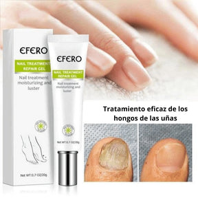 Crema de eliminación de hongos + regalos [RESULTADO COMPROBADO].