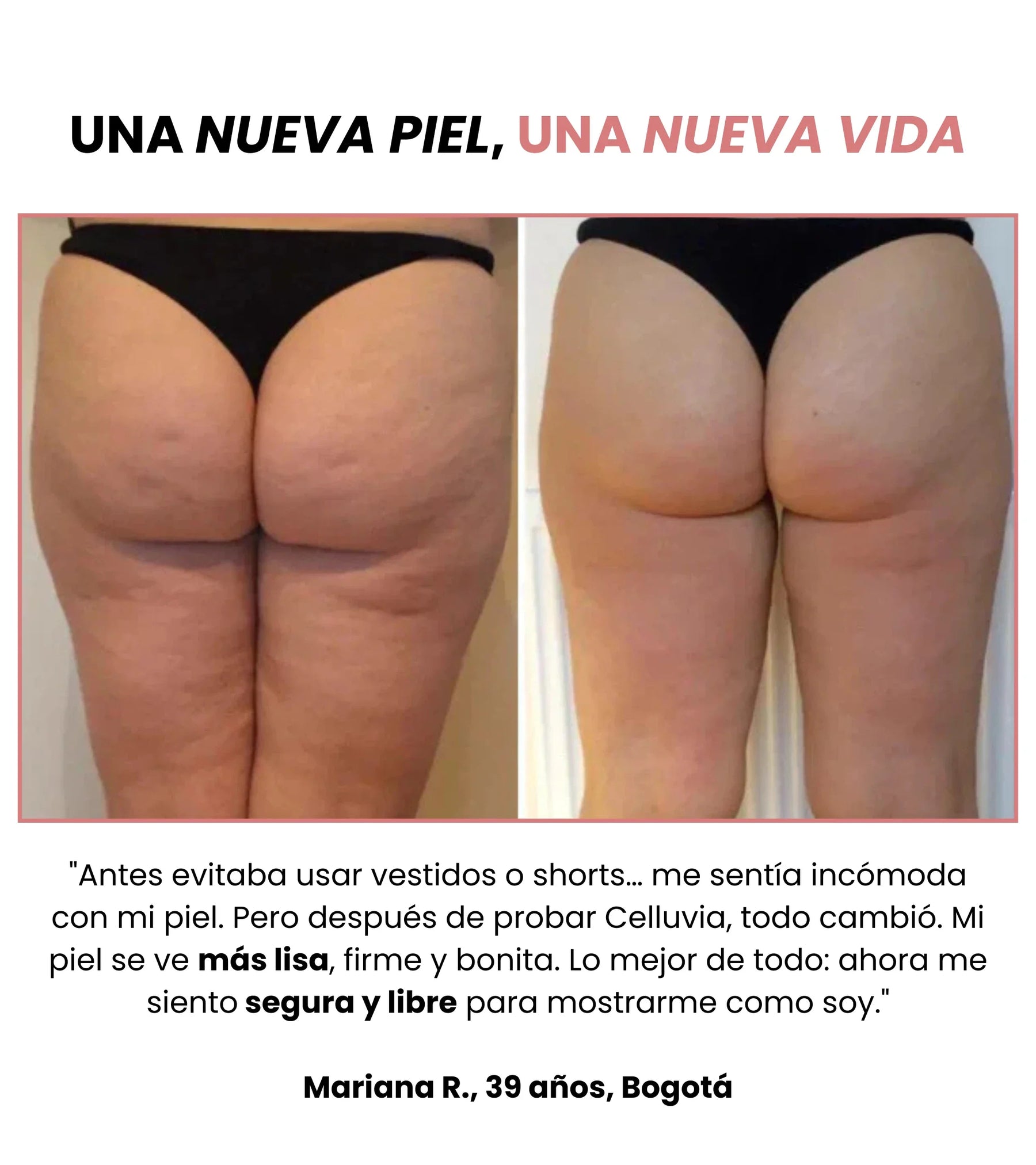 Belliva™ Kit Masajeador Anticelulítico
