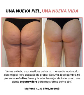 Belliva™ Kit Masajeador Anticelulítico